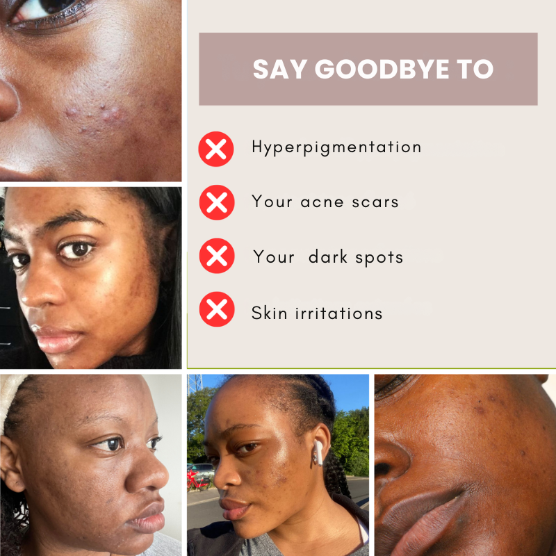 Turmeric & Kojic Acid Cleansing Pads
