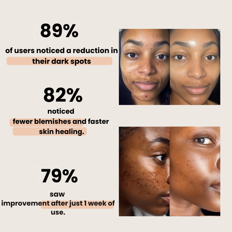 Turmeric & Kojic Acid Cleansing Pads