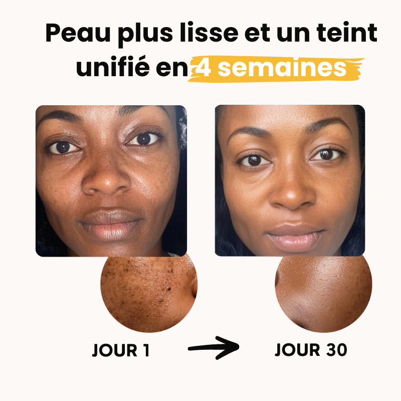 Turmeric & Kojic Acid Glow Wash